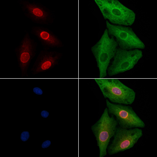 MSX1/MSX2 Antibody in Immunocytochemistry (ICC/IF)