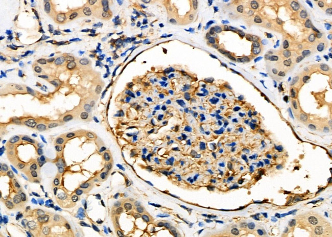 Herpes Simplex Virus Type 7 (strain JI) Antibody in Immunohistochemistry (Paraffin) (IHC (P))