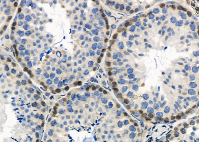 SUPT4H1 Antibody in Immunohistochemistry (Paraffin) (IHC (P))