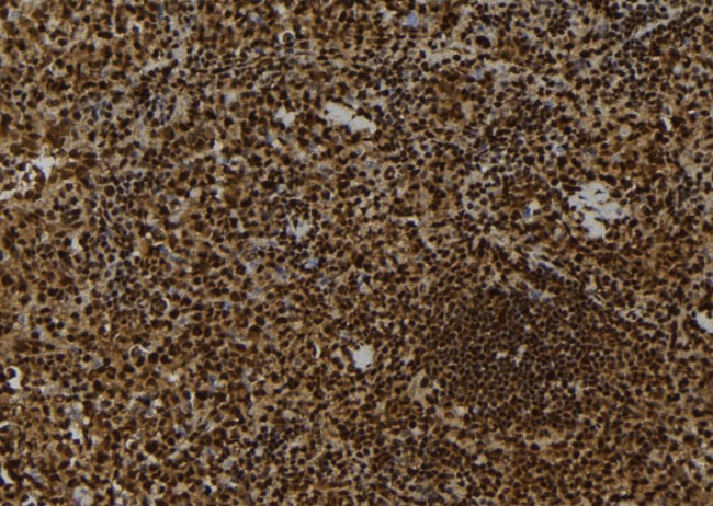 MLK1 Antibody in Immunohistochemistry (Paraffin) (IHC (P))