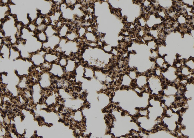 TMPRSS15 Antibody in Immunohistochemistry (Paraffin) (IHC (P))