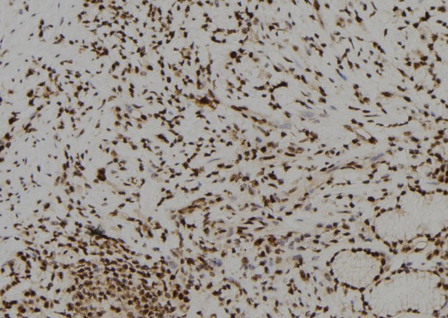 BNC1 Antibody in Immunohistochemistry (Paraffin) (IHC (P))