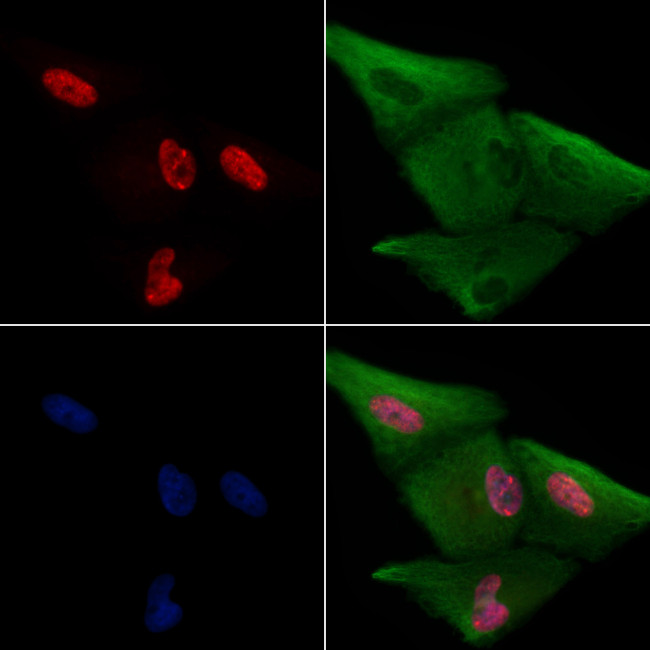 EMX2 Antibody in Immunocytochemistry (ICC/IF)