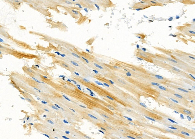 WT1-AS Antibody in Immunohistochemistry (Paraffin) (IHC (P))