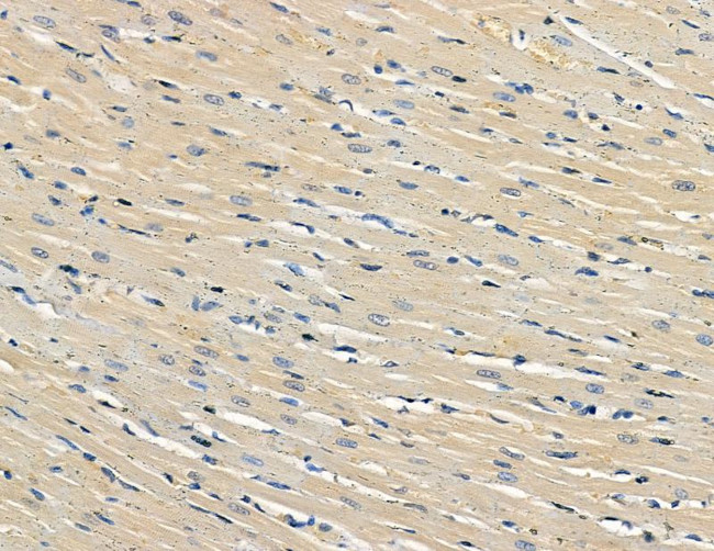 FHL3 Antibody in Immunohistochemistry (Paraffin) (IHC (P))