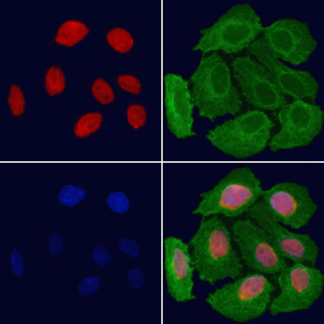 CCRN4L Antibody in Immunocytochemistry (ICC/IF)