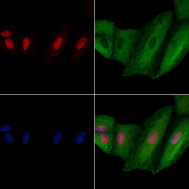 SART3 Antibody in Immunocytochemistry (ICC/IF)