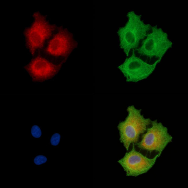 LRRK1 Antibody in Immunocytochemistry (ICC/IF)