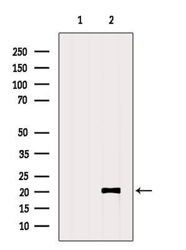 CT83 Antibody in Western Blot (WB)
