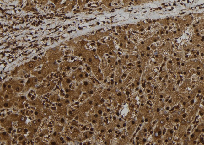 CT47 Antibody in Immunohistochemistry (Paraffin) (IHC (P))