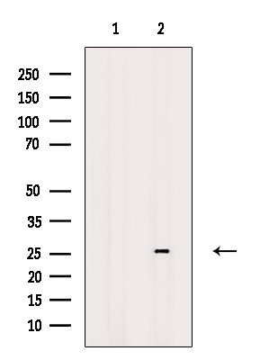 RNF141 Antibody in Western Blot (WB)