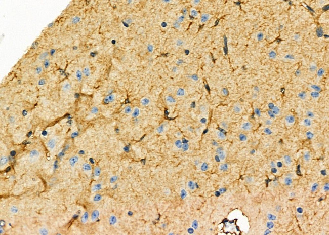 TNFAIP8L1 Antibody in Immunohistochemistry (Paraffin) (IHC (P))