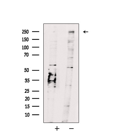 MORF Antibody in Western Blot (WB)