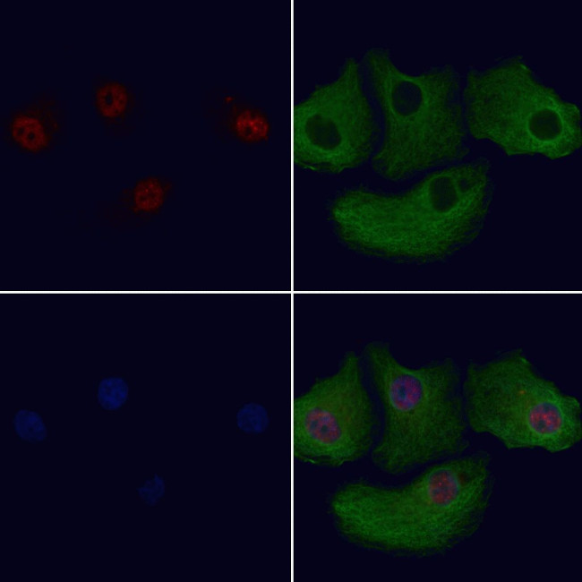 ZNF496 Antibody in Immunocytochemistry (ICC/IF)