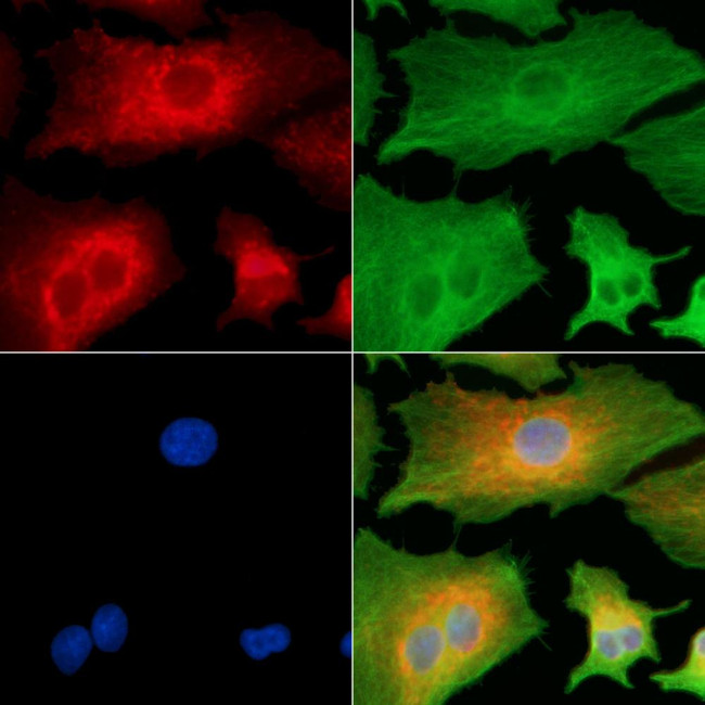 TPD52L3 Antibody in Immunocytochemistry (ICC/IF)