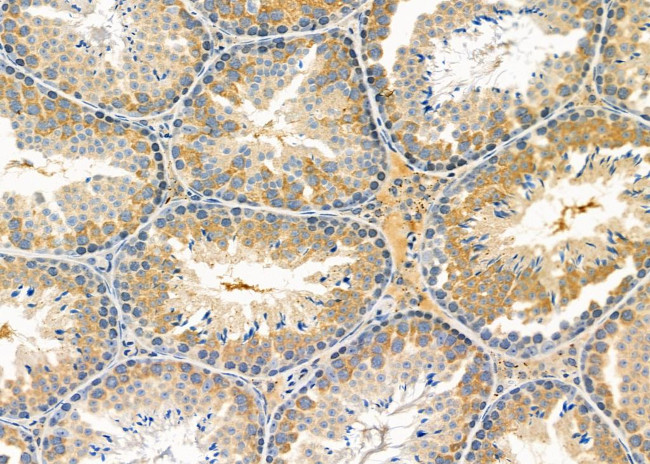 C19orf61 Antibody in Immunohistochemistry (Paraffin) (IHC (P))