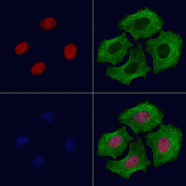 CBX8 Antibody in Immunocytochemistry (ICC/IF)