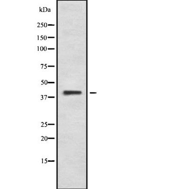 BARHL2 Antibody in Western Blot (WB)