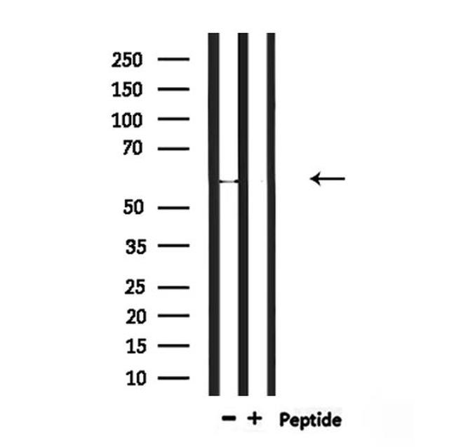 RBPJL Antibody in Western Blot (WB)