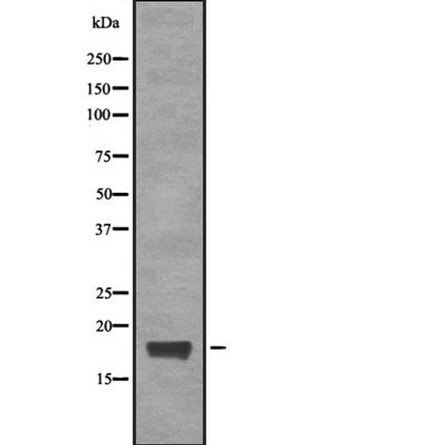 CGGBP1 Antibody in Western Blot (WB)