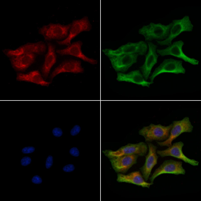 Adenylate Kinase 5 Antibody in Immunocytochemistry (ICC/IF)