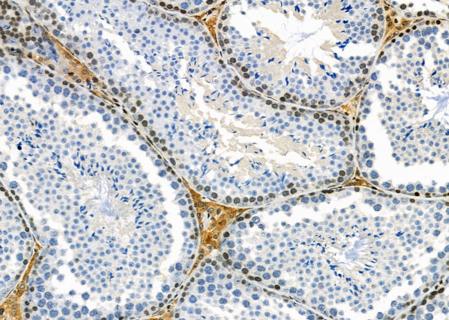 COL16A1 Antibody in Immunohistochemistry (Paraffin) (IHC (P))