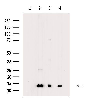 COX5B Antibody in Western Blot (WB)