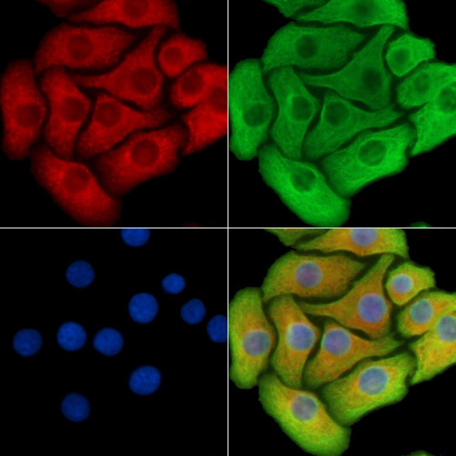 CDK5RAP1 Antibody in Immunocytochemistry (ICC/IF)