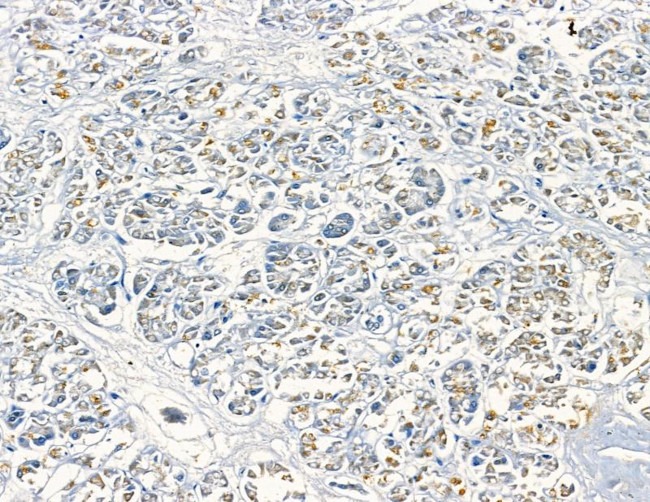 CDCA7L Antibody in Immunohistochemistry (Paraffin) (IHC (P))