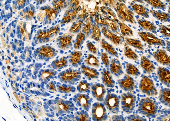 FAM215A Antibody in Immunohistochemistry (Paraffin) (IHC (P))