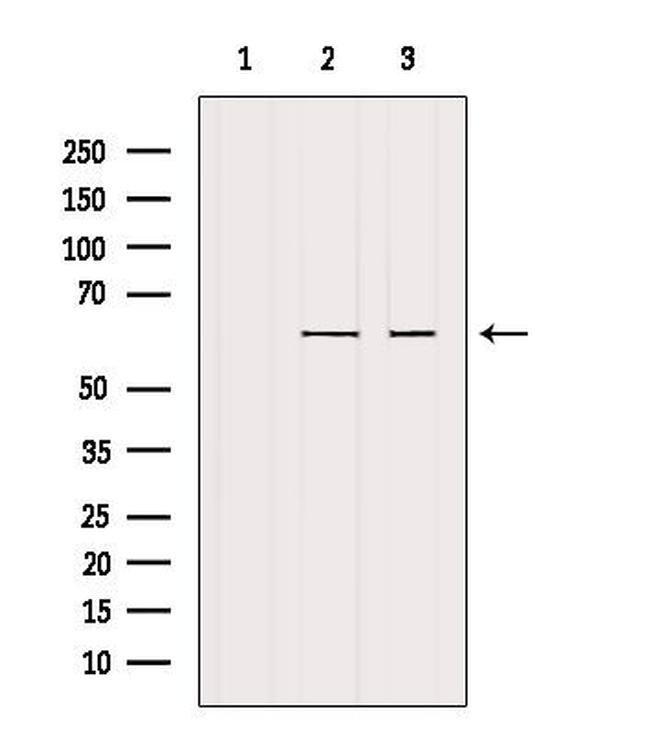 CYP4F22 Antibody in Western Blot (WB)