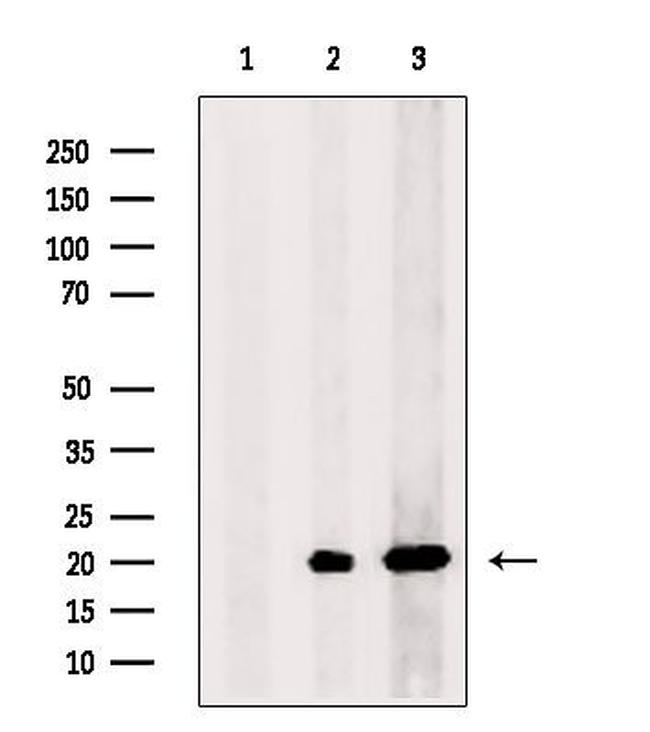 COX7A2 Antibody in Western Blot (WB)