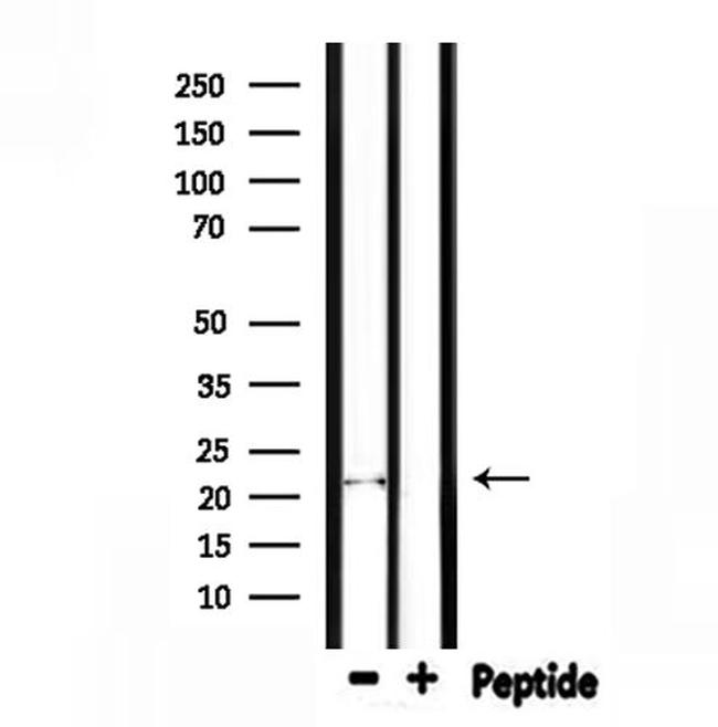 FGF6 Antibody in Western Blot (WB)