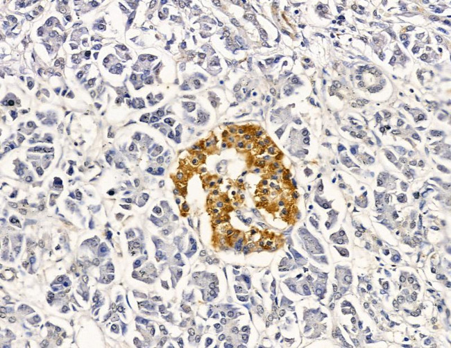 GTSE1 Antibody in Immunohistochemistry (Paraffin) (IHC (P))