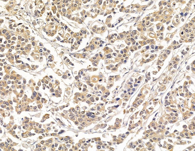 HSBP1 Antibody in Immunohistochemistry (Paraffin) (IHC (P))
