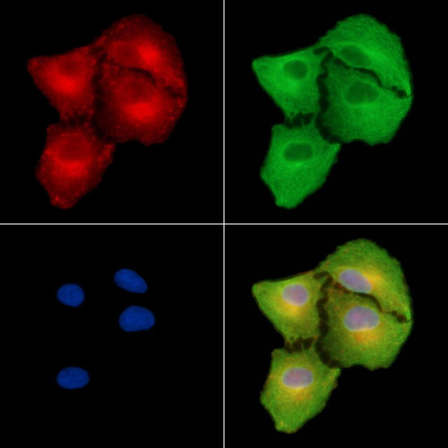 IFITM2 Antibody in Immunocytochemistry (ICC/IF)