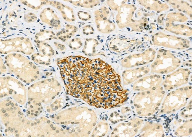 IFNA14 Antibody in Immunohistochemistry (Paraffin) (IHC (P))