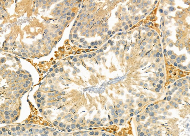 IFNA17 Antibody in Immunohistochemistry (Paraffin) (IHC (P))