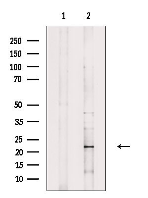 Interferon alpha-6 Antibody in Western Blot (WB)
