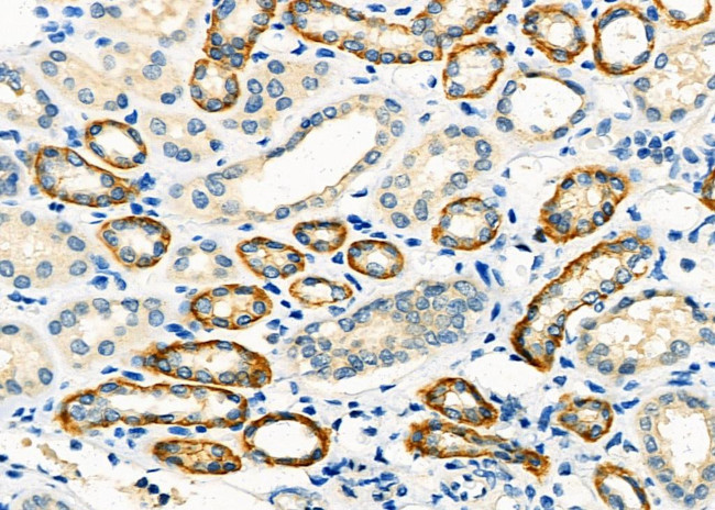 IGFL3 Antibody in Immunohistochemistry (Paraffin) (IHC (P))