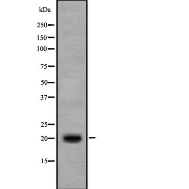 IL17B Antibody in Western Blot (WB)