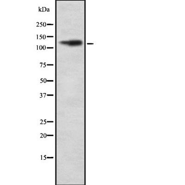 CD11d Antibody in Western Blot (WB)
