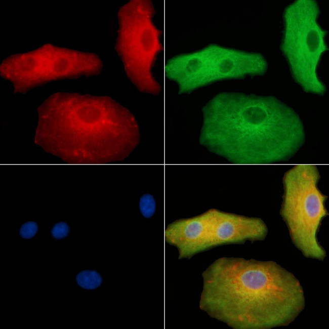 ITGB1BP2 Antibody in Immunocytochemistry (ICC/IF)