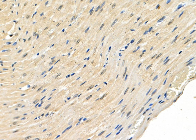 KDM5A Antibody in Immunohistochemistry (Paraffin) (IHC (P))