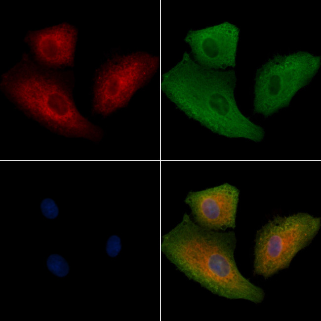 Keratin 32 Antibody in Immunocytochemistry (ICC/IF)