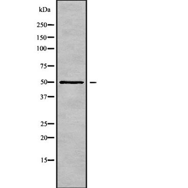 Cytokeratin 35 Antibody in Western Blot (WB)