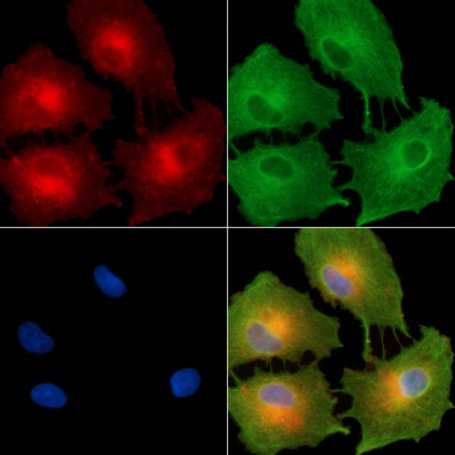 Cytokeratin 35/37/38 Antibody in Immunocytochemistry (ICC/IF)