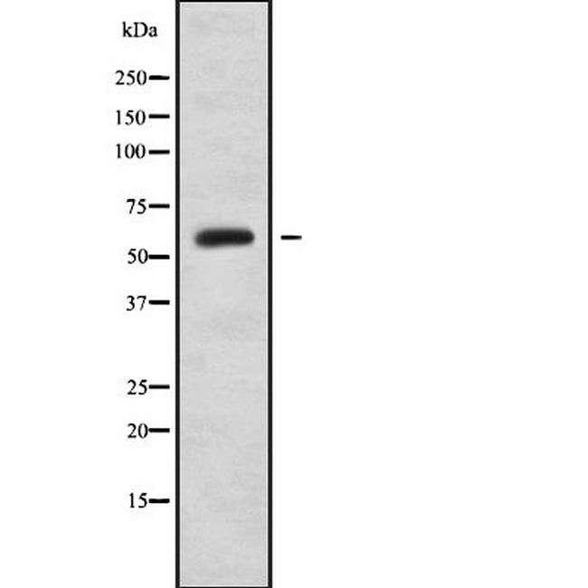 Cytokeratin Pan Type II Antibody in Western Blot (WB)