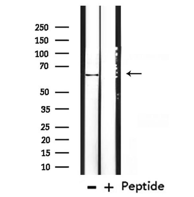 Cytokeratin 3 Antibody in Western Blot (WB)
