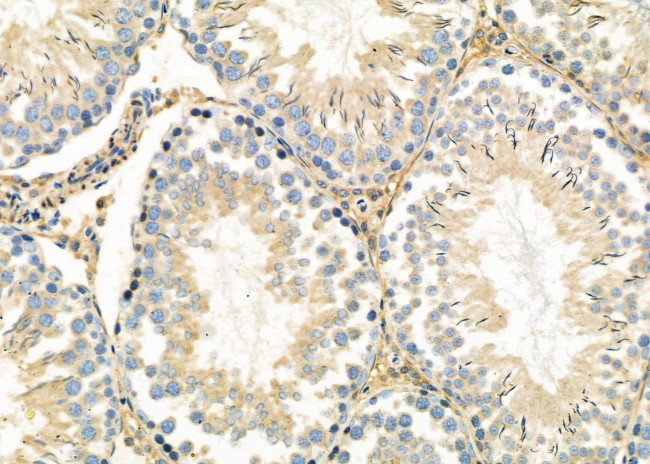 MAGEC3 Antibody in Immunohistochemistry (Paraffin) (IHC (P))